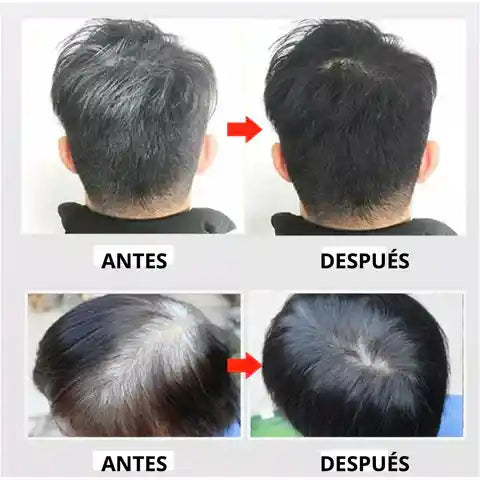 PIDE 1 Y LLEVA 2- Shampoo Black Hair Dye | Recupera tu tono natural sin tintes